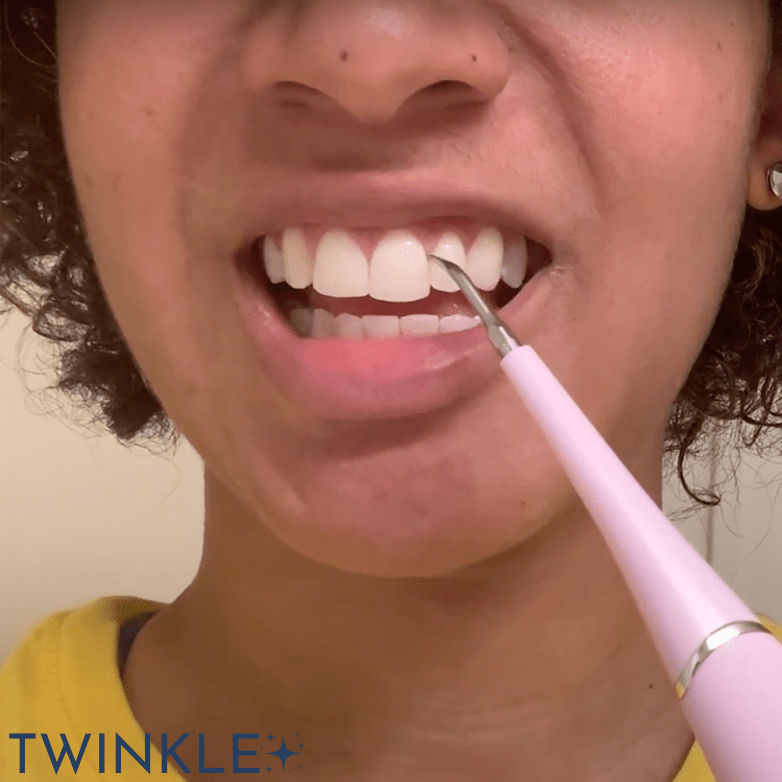 TWINKLE TEETH© - ULTRASONIC TOOTH CLEANER 2.0